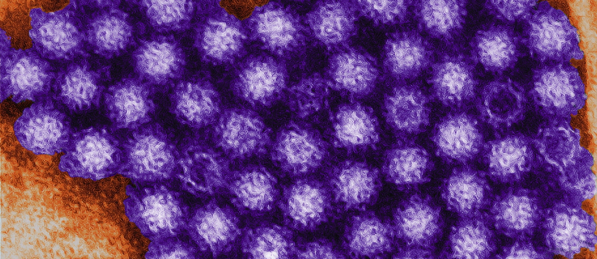 Norovirus Food Poisoning from Pesticides
